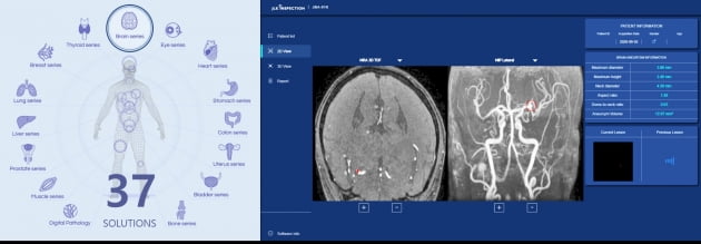 제이엘케이, AI 뇌동맥류 분석 솔루션 허가·보험 급여 신청