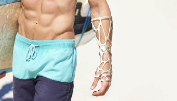 엑스켈렛 3D 프린팅 부목 제품 'Xkelet-3D-Printed-Splint' 착용 예시. 사진 제공=티앤알바이오팹