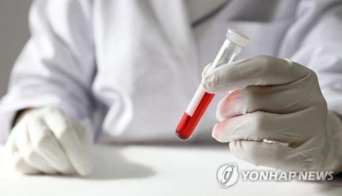 "코로나19 확진 후 혈액검사로 사망 위험 예측 가능"