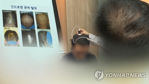 젊은 탈모인 급증하는 중국…韓 화장품 수입 3년새 60%↑