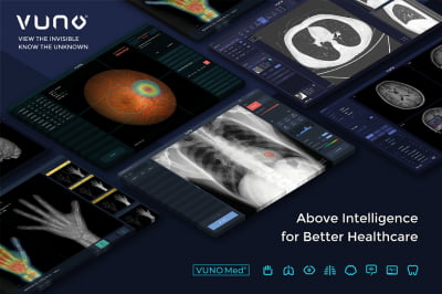 인공지능 의료기기 개발사 뷰노, 코스닥 예비심사 통과