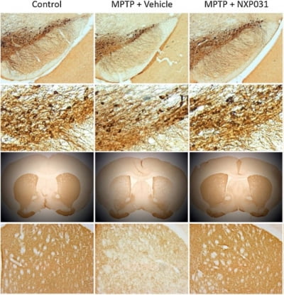 넥스모스, 압타머로 파킨슨병 치료 가능성 입증