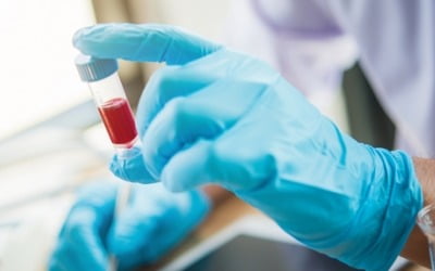 인트론바이오, 출혈열증후군 진단키트 개발 국책과제 선정