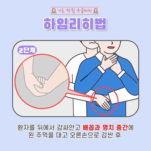 떡 먹다가 기도 막히면 배꼽·명치 중간 힘껏 쓸어올려야