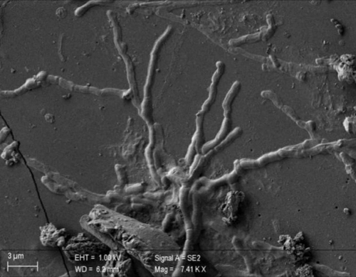 伊 폼페이에서 2천년간 손상되지 않은 인간 뇌세포 발견