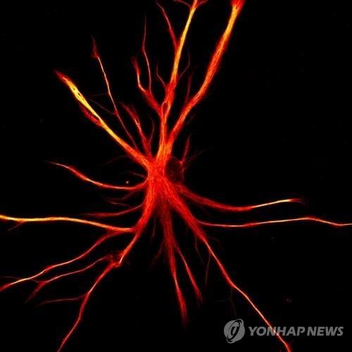 日연구팀, 유도만능줄기 세포 이용 암 치료 첫 임상시험