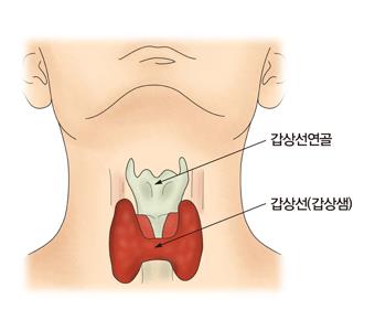 "임신 중 갑상선 호르몬 저하, 자녀 ADHD 위험↑"