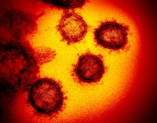 신종 코로나바이러스 감염증(코로나19)의 전자현미경 이미지.(사진=연합뉴스)