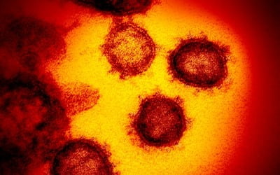 이탈리아서 코로나19 5개 변종 의심 바이러스 발견