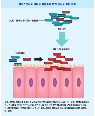 [커버스토리 part.2] 장내 미생물은 어떻게 신약이 됐나