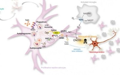 국내 연구진 일냈다…치매 유발 핵심과정 세계최초 규명
