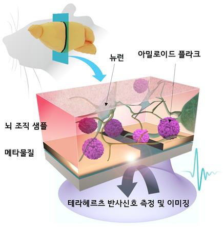 [사이테크 플러스] "조영제 없이 테라헤르츠파로 뇌속 치매원인 물질 측정한다"