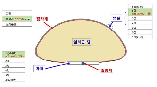 식약처 "한스바이오메드, 부적합 인공유방 생산해 7만개 유통"