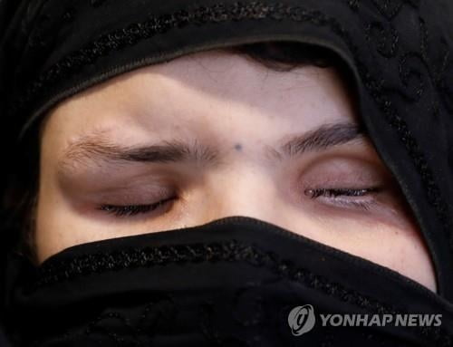 아프간 여성, 취직했다고 흉기에 두 눈 찔려 실명…"아버지 소행"