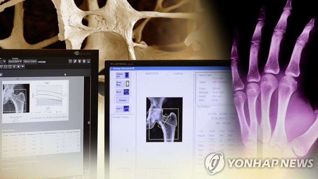 중증화상 수술비 부담 크게 덜어…'인공진피' 168만원→3만5천원