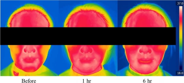 az-news-ai.blogspot.com - "마스크 쓰면 단시간에 피부 홍조·온도 증가" - 한국경제