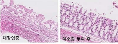 프로스테믹스 "마이크로바이옴 유래 엑소좀, 염증성장질환 효과"