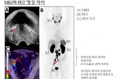 [김우섭 기자의 바이오 탐구영역] 퓨쳐켐 “전립선암 진단 기술 미국 수출 논의 중...세계 최고 기술력 인정받고 있어” 