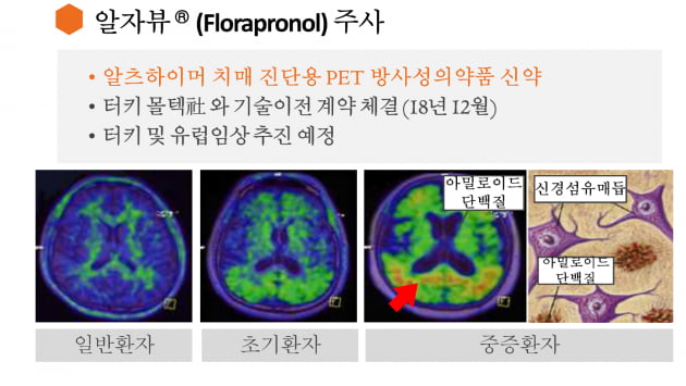 [김우섭 기자의 바이오 탐구영역]퓨쳐켐 "아두카누맙 승인 수혜 기대... 치매 진단 시장 급성장할 것"  