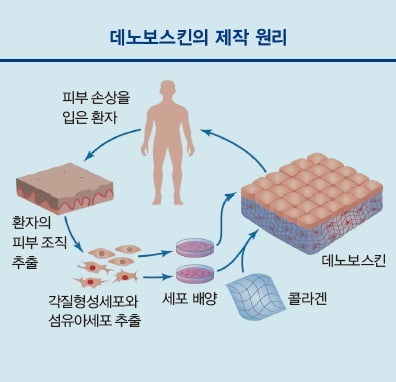 [해외 바이오 기업] 스위스 스타트업 CUTISS의 인공 피부조직 '데노보스킨'을 주목하라