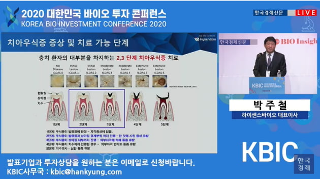 하이센스바이오 "세계 80조원 시린이 시장 노린다"