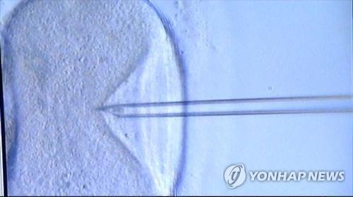 [톡톡일본] 제도 바깥에 있는 사유리 방식 '비혼 출산'