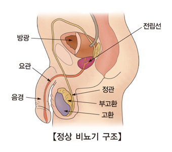 "방광암 진단 새로운 소변 검사법 정확도 100%"