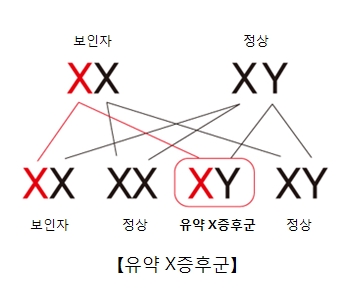 "취약 X증후군 최초 치료제 2상 임상시험 결과 양호"