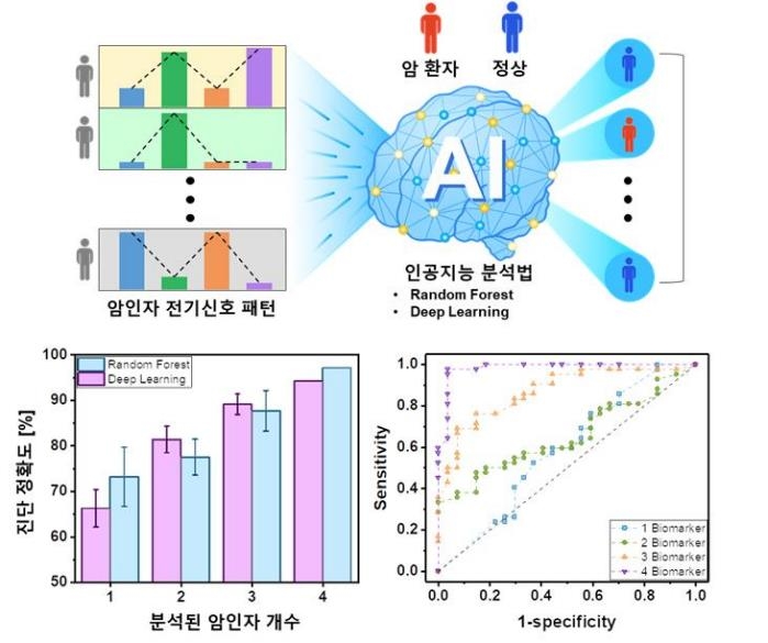 "'초고감도센서+AI' 소변검사로 20분 내 전립선암 정밀 진단"