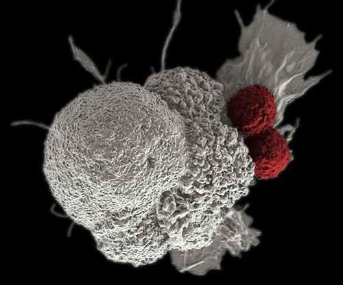 콜드 스프링 하버 연구소, 암 전이 늘리는 '비번역 RNA' 발견