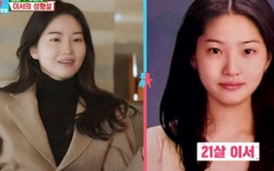 '전진♥' 류이서, 16년 전 사진 공개…"성형설 억울해" [종합]