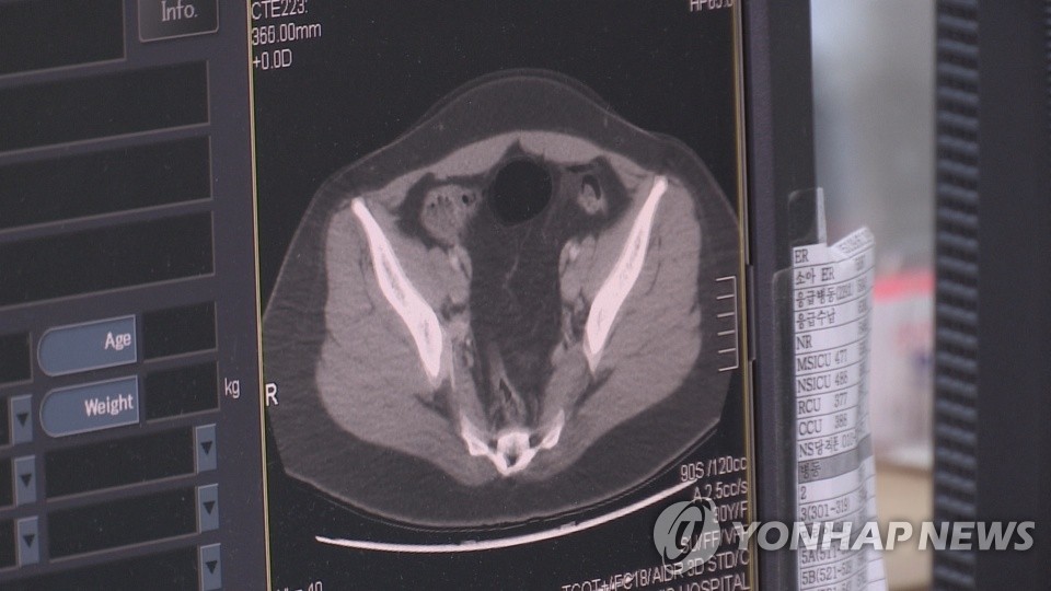 술 '조금만' 마시면 뇌졸중 예방?…"장기적으론 효과 없다"