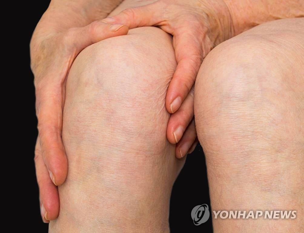 중장년 삶의 질 낮추는 관절 통증…男 고관절·女 무릎