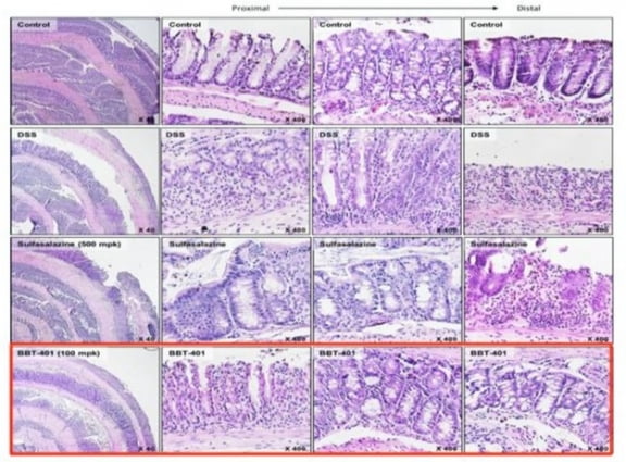 DSS 유도 대장염 동물모델에서 BBT401과 대조군 설파살라진의 대장 부위 염색 결과. DSS에 의해 대장 점막층이 손상되면서 융모 사이의 크립트(Crypt) 배열이 파괴되는 것을 확인할 수 있다.