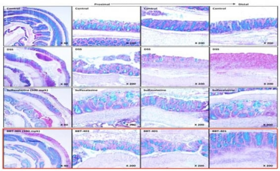 DSS 유도 대장염 동물모델에서 BBT-401과 설파살라진의 대장 부위 염색 결과. 파괴된 크립트 배열이 양성 대조군에 비해 BBT-401에서 정상 동물들과 더 유사한 수준으로 회복 및 장점막 재생능을 보이는 것을 관찰할 수 있다.