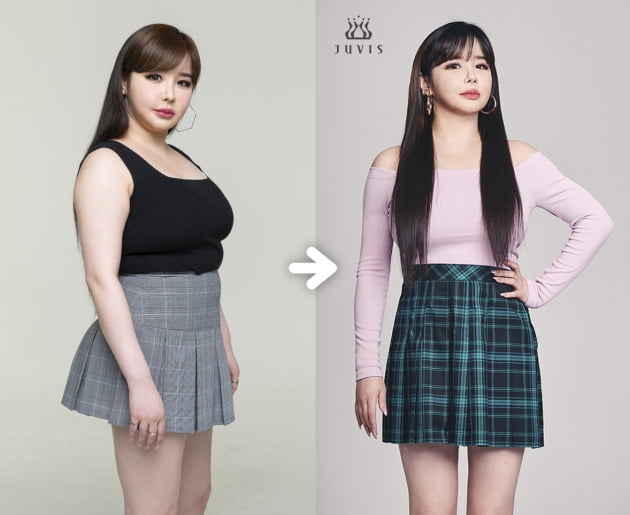 박봄, 다이어트로 11kg 감량 /사진=쥬비스 제공