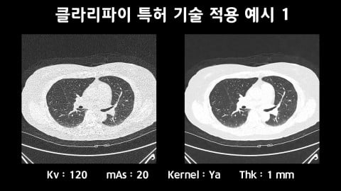 클라리파이, AI 기반 CT 잡음 제거 기술 美 특허 등록