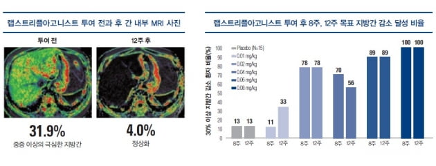 [파이프라인 아카이브] 한미약품 '랩스트리플아고니스트'