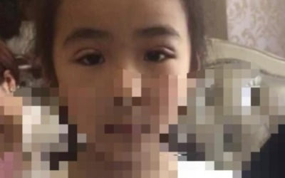 7살 딸에게 "쌍수하러 가자"…중국 휩쓰는 '성형 광풍' [조아라의 소프트차이나]