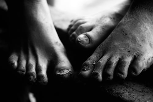 아프리카 아이들의 발은 성한 곳이 없다. 신발만 신어도 파상품 등 질병으로 인한 사망률을 20% 정도 줄일 수 있다고 한다.