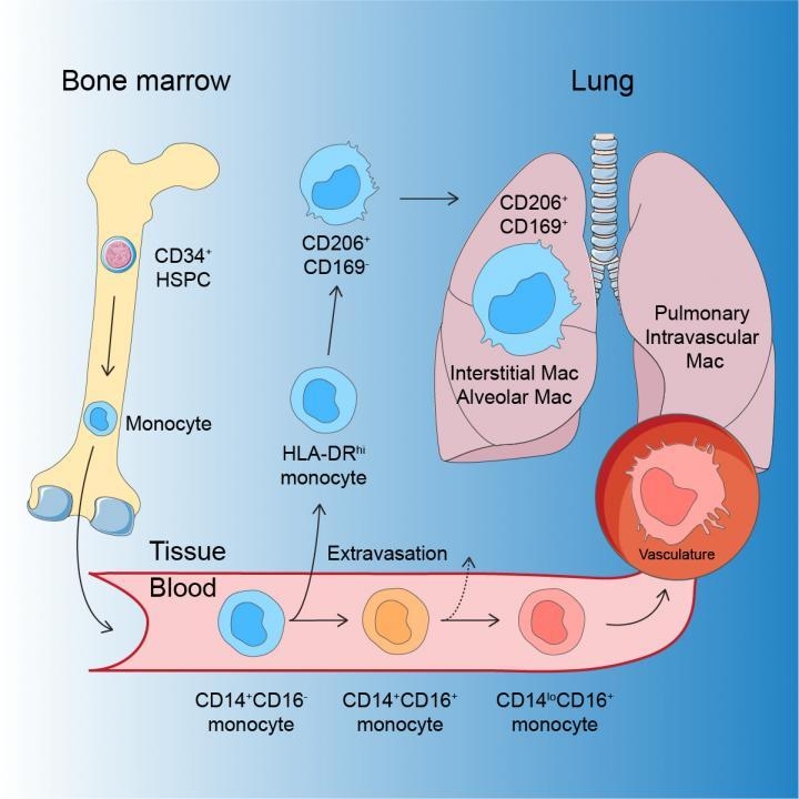 코로나19 중증 폐 질환 일으키는 대식세포 따로 있다