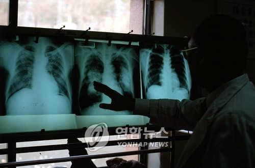 숨 쉬는 것도 고통 1만6천 진폐환자 "백신 우선 접종을"