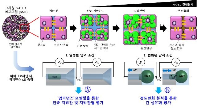 비알코올성 지방간 진행 정도 비침습적으로 측정한다