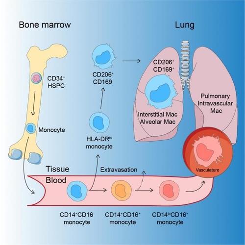 The'real danger' of COVID-19 pneumonia is hidden behind the slow spread