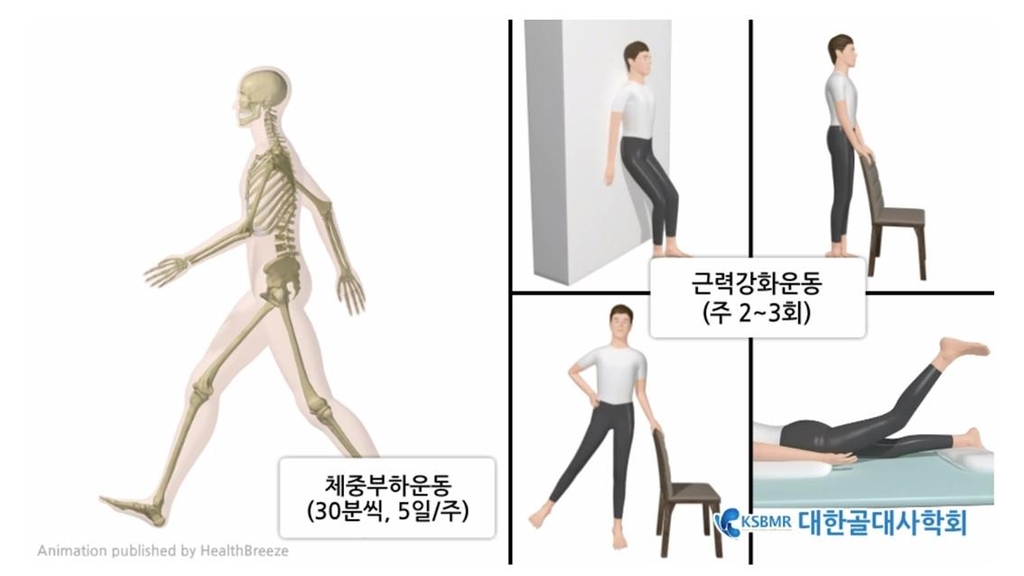 [김길원의 헬스노트] 낙상이 골절 부른다?…근본 원인은 '골다공증'