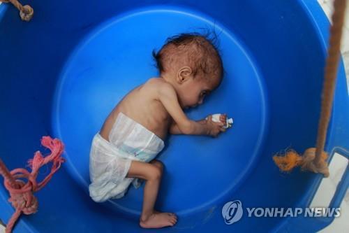 백신이 중동민낯 노출…배부른 사우디와 생지옥 된 예멘