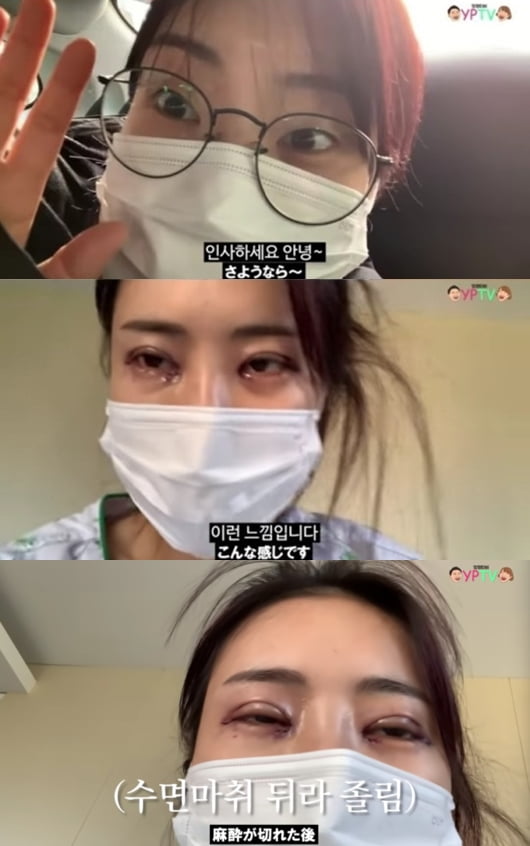 Lee Se-young’s double eyelid sprain surgery…  Good for Synthesis