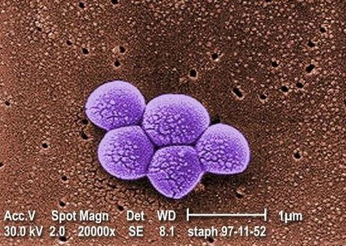 The real danger of COVID-19 pneumonia is hidden behind a slow spread