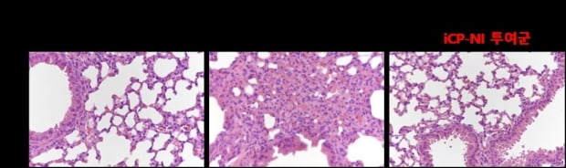 코로나19 폐조직 손상모델은 산소교환을 위한 폐 다공성 구조와 기능을 상실(가운데)했으나, iCP-NI 투여군(오른쪽)의 폐 조직은 비감염 대조군(왼쪽)과 동일하게 폐조직 파괴가 없음. 제공=셀리버리
