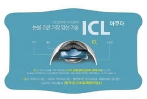 라식· 라섹 할 수 없다면 …… '아쿠아 ICL 렌즈삽입술' 주목